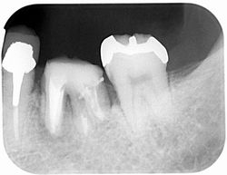 fu-ka 2015年08月31日172201 ブログ
